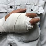 Close up of hand in cast
